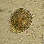 <em>Balantidium coli</em> é um protista ciliado causador da balantidiose, uma infecção do intestino grosso que provocam diarreia com sangue nas fezes, de modo semelhante ao que ocorre na disenteria amebiana. </br></br> Palavra-chaves: <em>Balantidium coli</em>, balantidiose, protista ciliado, diarreia.