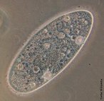 Os protistas são seres vivos unicelulares e eucariontes; portanto possuem núcleo individualizado, envolvido por membrana. Possuem também organelas membranosas diversas. Nesse grupo, incluem-se os paramécios que são organismos ciliados, de corpo translúcido, achatados, e alcançam um tamanho de 200 micra, ou seja, 2 décimos de milímetro. </br></br> Palavra-chaves: protista, protozoário, paramécio, unicelular.