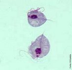 A tricomonase  causada pela espcie <em>Trichomonas vaginalis</em> que afeta o sistema urogenital humano. </br></br> Palavras-chave: protista, protozorio, <em>Trichomonas vaginalis</em>, urogenital. 