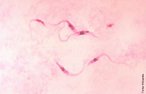 <em>Trypanosoma cruzi </em>