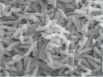 <em>Vibrio cholerae</em>: A bactéria que causa cólera (ao microscópio eletrônico) <br /><br /> Palavras-chave: cólera, vibrião colérico, bactéria, microscópio eletrônico.