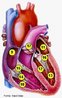 A imagem representa as seguintes partes do coração: <br /> 9 - Átrio Direito <br /> 10 - Ventrículo Direito <br /> 11 - Átrio Esquerdo <br /> 12 - Ventrículo Esquerdo <br /> 13 - Músculos Papilares <br /> 14 - Cordoalhas Tendíneas <br /> 15 - Válvula Tricúspide <br /> 16 - Válvula Mitral <br /> 17 - Válvula Pulmonar <br /><br /> Palavras-chave: coração, sistema cardiovascular.