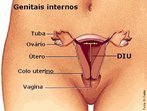  um artefato colocado dentro da cavidade uterina para impedir a gestao. Existem vrios tipos.  um mtodo de contracepo, associado a poucos efeitos colaterais. Possui variados tipos de idealizao e comercializao, construdo com diferentes materiais e com diversas formas. Os DIUs atualmente usados so  base de fios de cobre que destroem os espermatozides dentro do tero, no permitindo portanto a fecundao. </br></br> Palavras-chave: DIU (Dispositivo Intra Uterino), efeitos, fecundao, infeces, mtodo contraceptivo.  