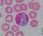 Eosinfilo