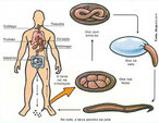 A ancilostomose  causada pelo nematelminto tanto pelo <em>Ancylostoma duodenale</em> ou pelo <em>Necatur americanus</em>. A doena pode tambm ser conhecida mente como amarelo, doena do jeca-tatu, mal-da-terra, anemia-dos-mineiros, opilao, etc. As pessoas portadoras desta verminose so plidas, com a pele amarelada, pois os vermes vivem no intestino delgado e, com suas placas cortantes ou dentes, rasgam as paredes intestinais, sugam o sangue e provocam hemorragias e anemia. </br>Ciclo de vida: </br>1 - a larva sai do ovo e sofre transformaes no solo; </br>2 - Aps modificaes elas podem penetrar na pele de seres humanos, principlamente pelos ps; </br>3 -Caem na corrente sangunea e chegam ao corao; </br>4- Do corao vo para os pulmes; </br>5- Dos pulmes as larvas so expelidas por meio de tosses, alcanam a laringe e so deglutidas e vo se fixar no intestino delgada. No intestino as larvas amadurecem e reproduzem eliminando os ovos com as fezes do hospedeiro. <br /><br /> Palavras-chave: ancilostomose, nematelminto, amarelo.