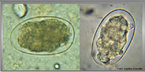 Os ovos dos helmintos causadores da ancilostomíase possuem forma ovalada, casca fina e transparente e um espaço largo e claro entre a casca e o conteúdo dos ovos. As larvas rebditóide apresentam bulbo esofageano (esôfago do tipo rabditóide) e vestibulo bucal longo. Já as larvas filarióide apresentam esôfago cilíndrico (do tipo filarióide) e cauda pontiaguda. <br /><br /> Palavras-chave: ancilostomose, nematelminto, amarelão.