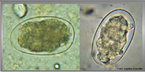 Ancilostomase - ovos