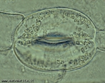 Microscopia de um estmato, que  uma estrutura responsvel pelas trocas gasosas da planta. </br></br> Palavras-chave: microscopia, estmato, planta, botnica. 