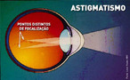 Uma crnea normal  redonda e lisa, como uma bola de beisebol. Com o astigmatismo, a curvatura da crnea fica mais ovalada, como uma bola de futebol americano. Para as pessoas que sofrem de astigmatismo, todos os objetos - tanto prximos como distantes - ficam distorcidos. As imagens ficam embaadas porque alguns dos raios de luz so focalizados e outros no. A sensao  parecida com a distoro produzida por um pedao de vidro ondulado.  <br /><br /> Palavras-chave: astigmatismo. crnea, diagnstico, hereditariedade, hipermetropia, miopia. oftalmologista, preveno, refrao, tratamento. 